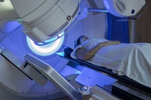 Study Shows That Radiotherapy Before Mesothelioma Surgery Extends Survival